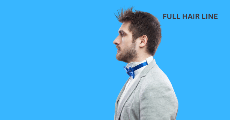 Man with full healthy hairline before hair loss - side profile view showing thick hair and natural hairline position